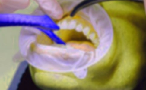 第一次拔牙作文(合集10篇)