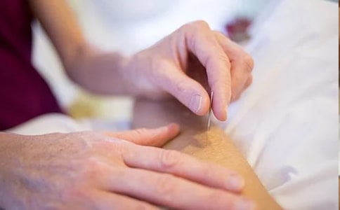 針灸推拿專業(yè)畢業(yè)實習(xí)報告范文